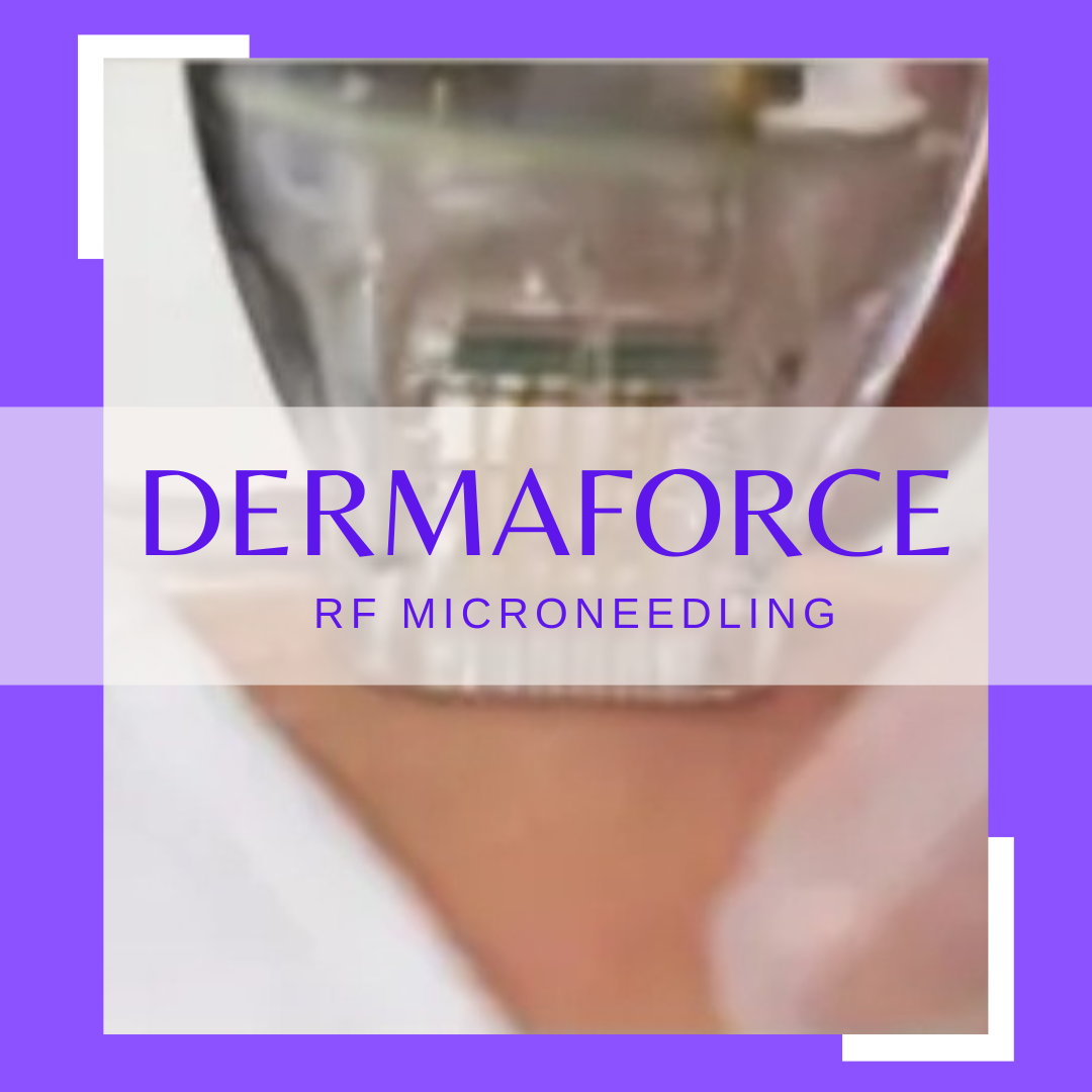 RF Micro-needling Glasgow West End | 3D Dermaforce Skin Tightening at ...